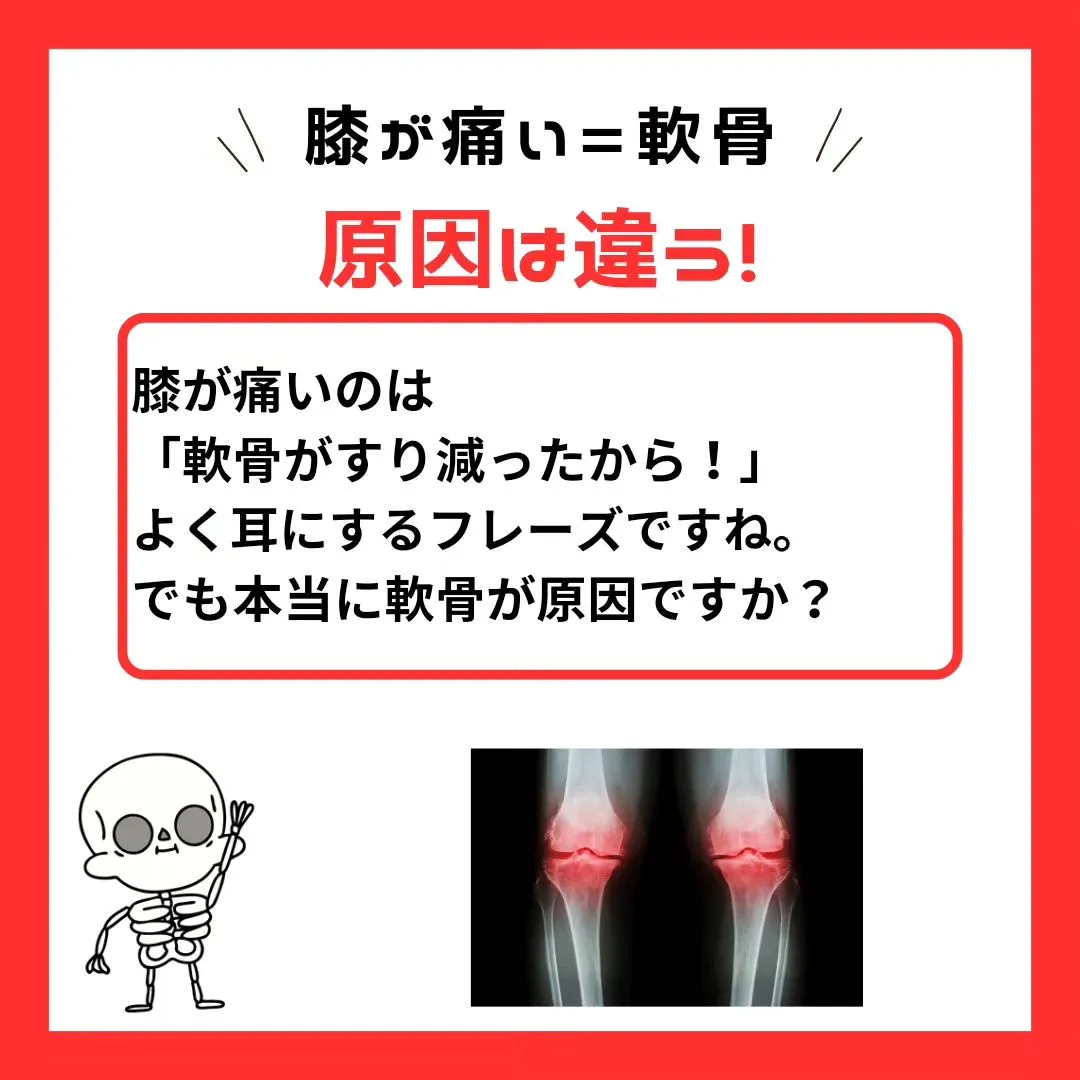 【膝痛の原因は違う！】その膝の痛みは軟骨が原因ではありません...