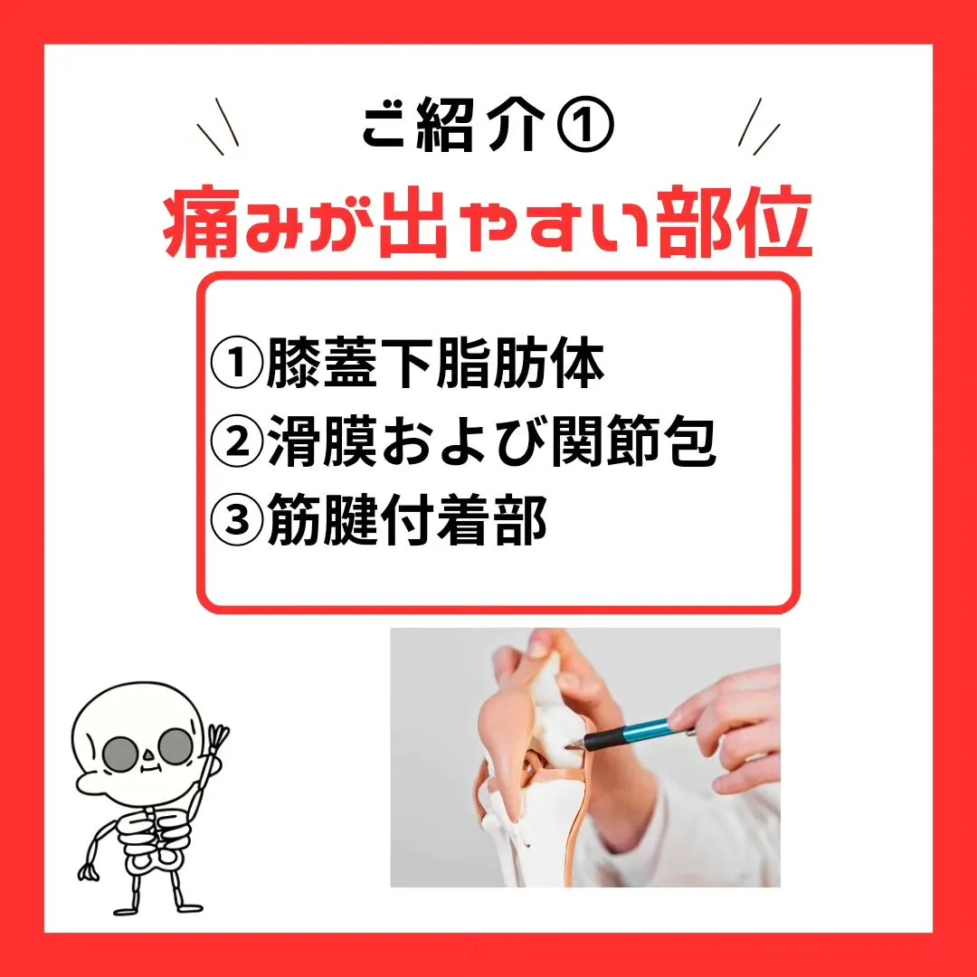 【膝痛の原因は違う！】その膝の痛みは軟骨が原因ではありません...