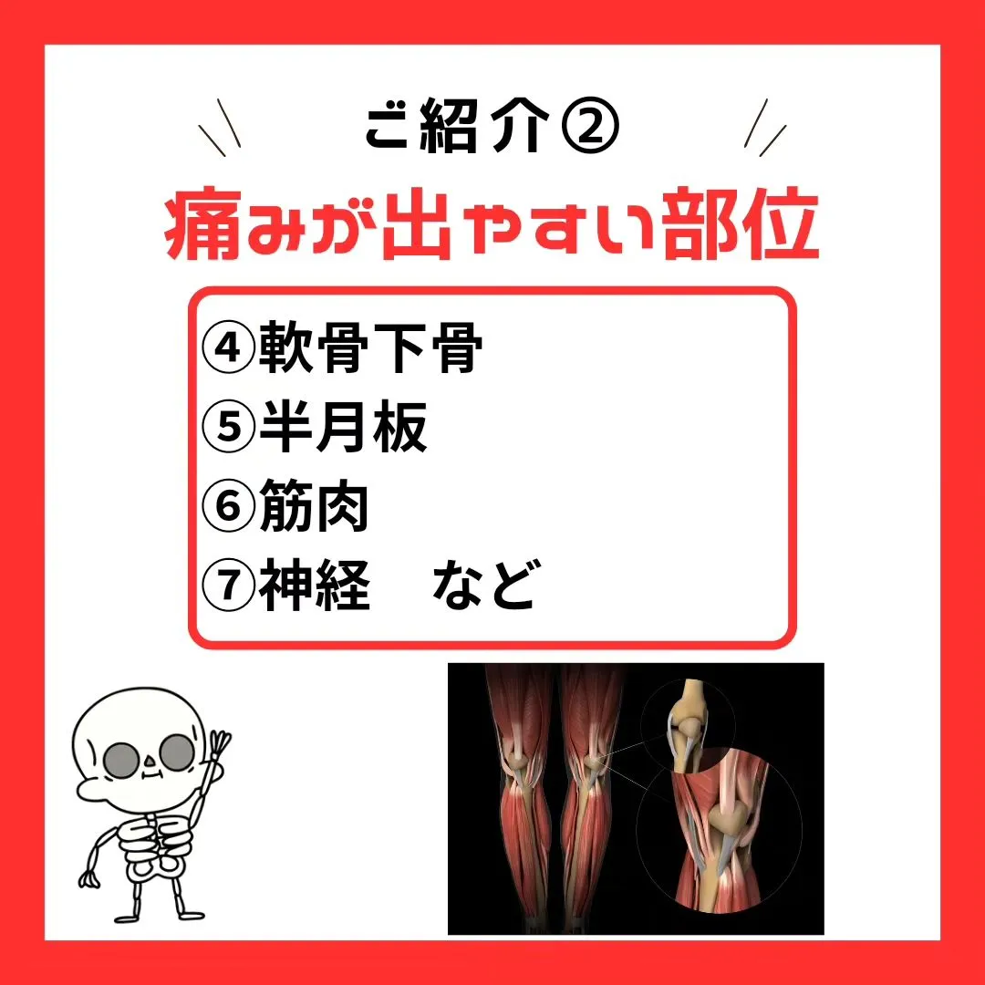 【膝痛の原因は違う！】その膝の痛みは軟骨が原因ではありません...